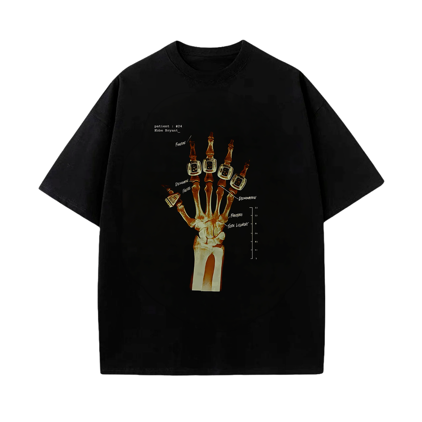 Camiseta Kobe Bryant Radiografía